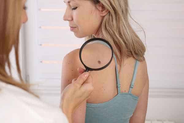 What Are Traditional Skin Lesion Removal Methods Old Trafford?
