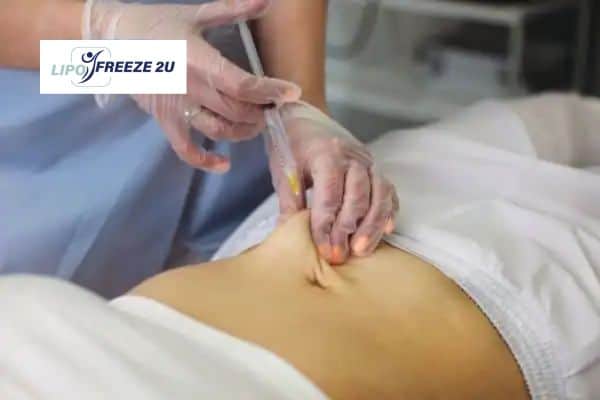 Fat Dissolving Injections Old Trafford & Weight loss medication