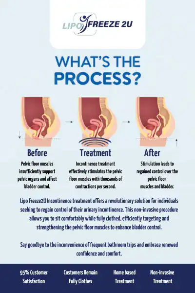 Diagram of how incontinence treatment Old Trafford works.