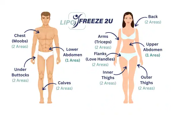 Areas you can have fat freezing treatment Old Trafford