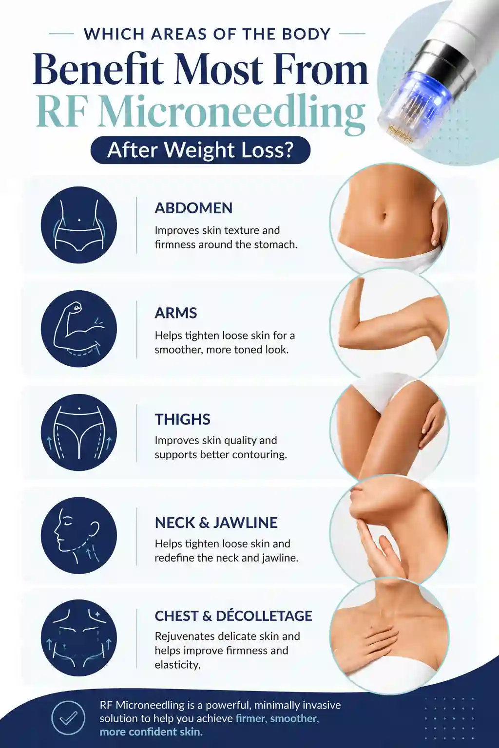 Which Areas of the Body Benefit Most From RF Microneedling After Weight Loss Old Trafford